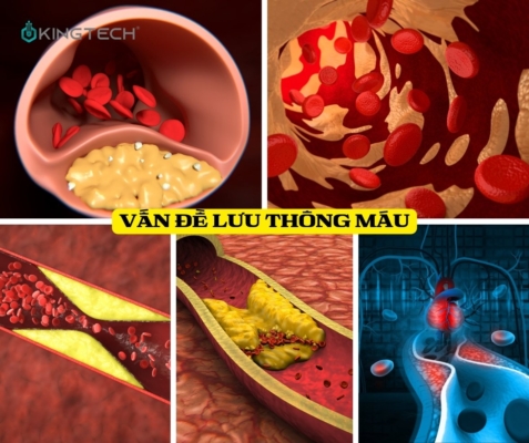 Đau Nhức Toàn Thân và Cách Khắc Phục