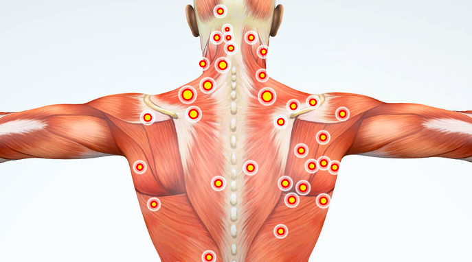 mô tả nút thắt cơ thường xuyên xảy ra