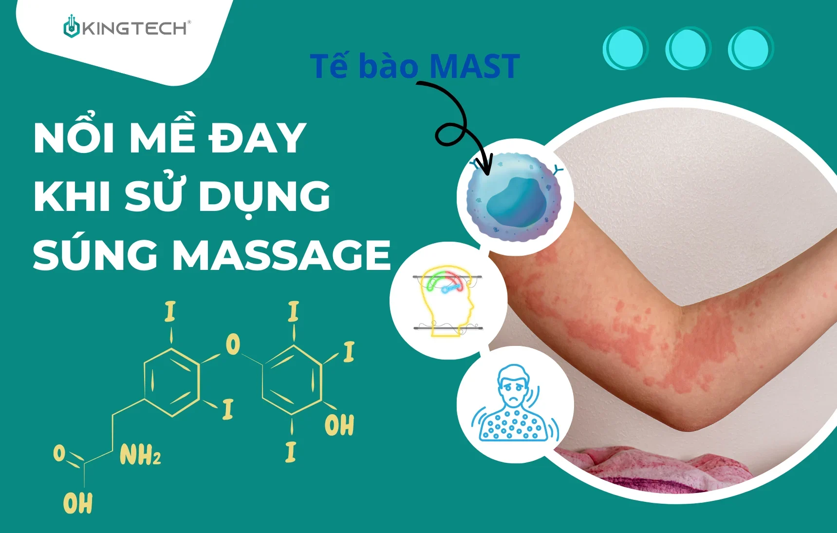 Nguyên nhân bị ngứa khi sử dụng máy massage