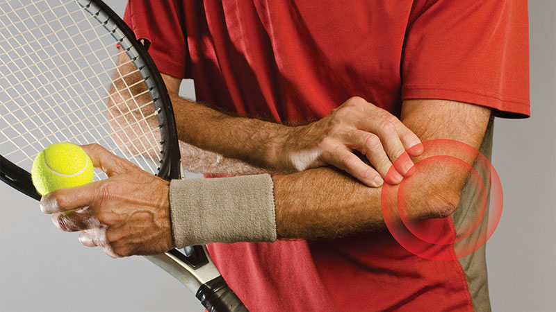 Trigger Point