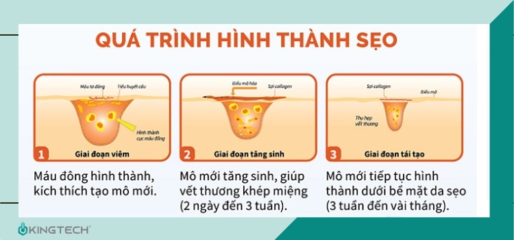 Quá trình hình thành sẹo