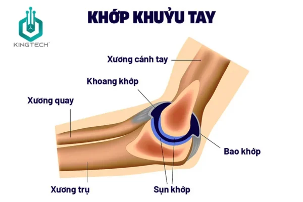 Cách sử dụng súng massage cho hội chứng khuỷu tay