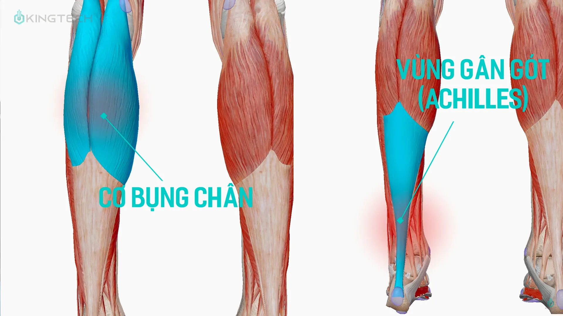 Cách sử dụng súng massage cho viêm gân gót