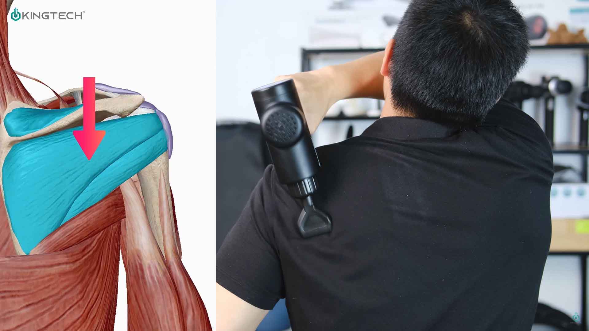 Cách sử dụng súng massage hỗ trợ đau vai.