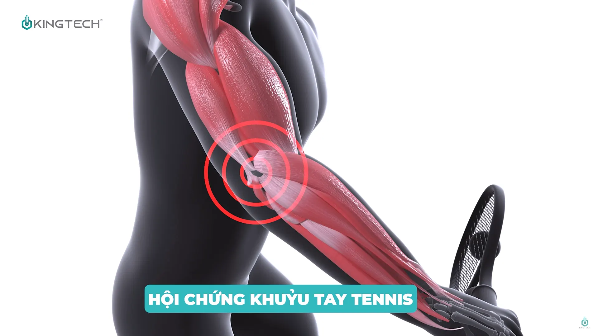 Cách sử dụng súng massage cho hội chứng khuỷu tay