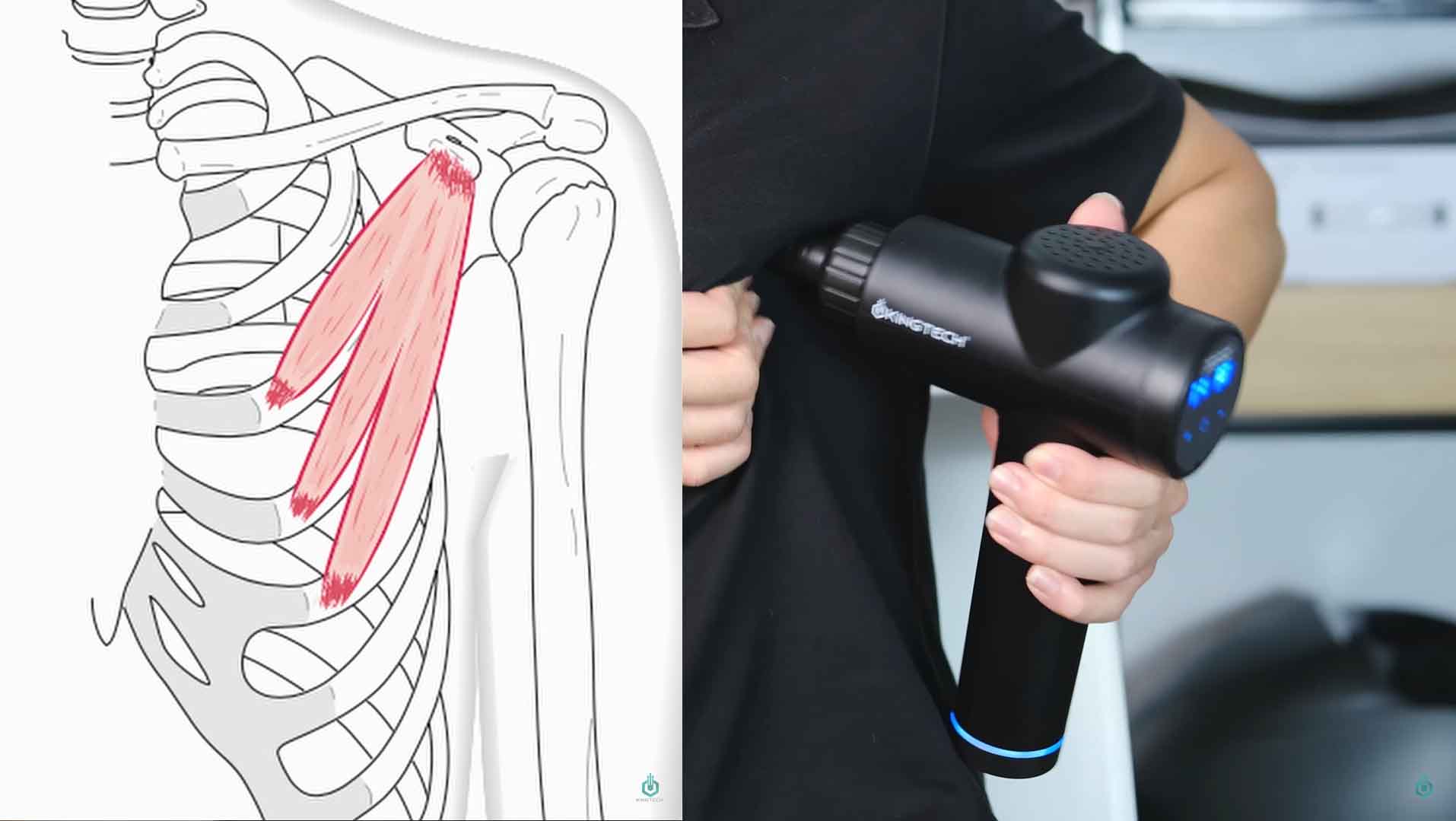 Cách sử dụng súng massage hỗ trợ đau vai.