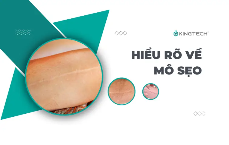 Có nên sử dụng súng massage cho vùng bị sẹo?