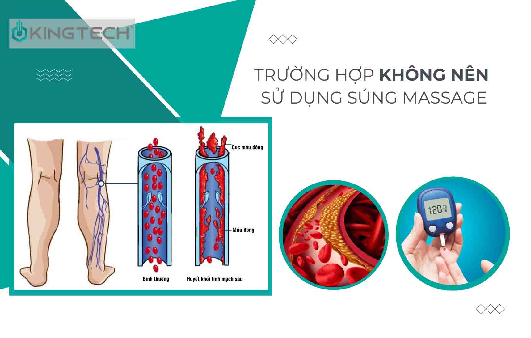 Cách sử dụng súng massage hỗ trợ tình trạng chuột rút