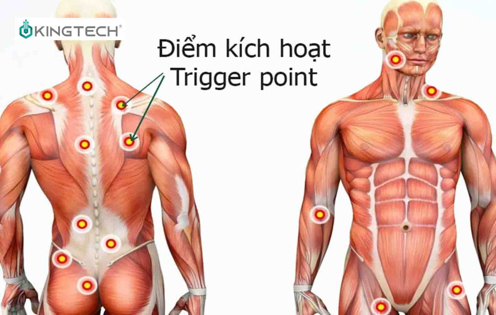 Cải thiện đau lưng dưới bằng 10 điểm Trigger Point