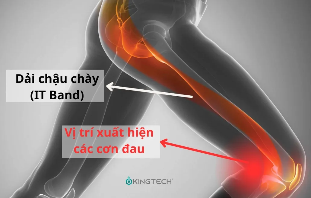 Cách sử dụng súng massage cho hội chứng dải chậu chày