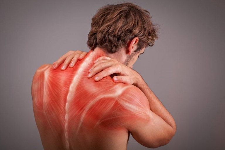 Nguyên nhân dẫn đến vùng cơ bị căng