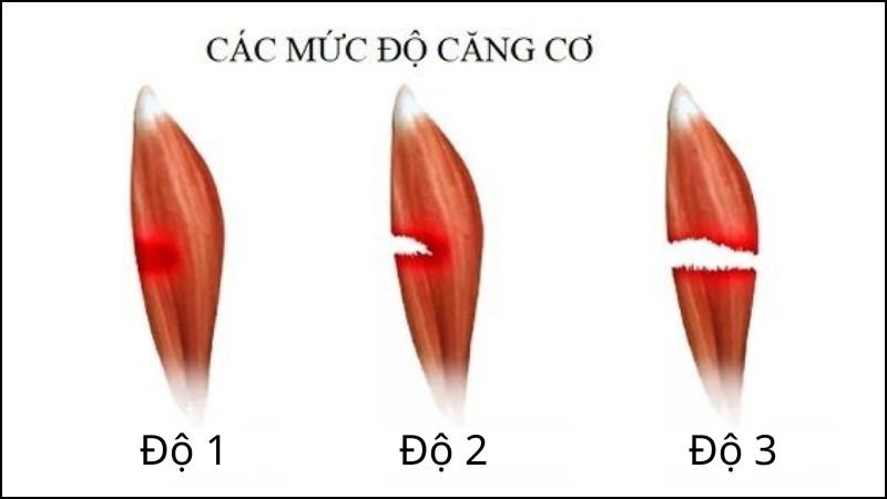 Căng cơ là gì?